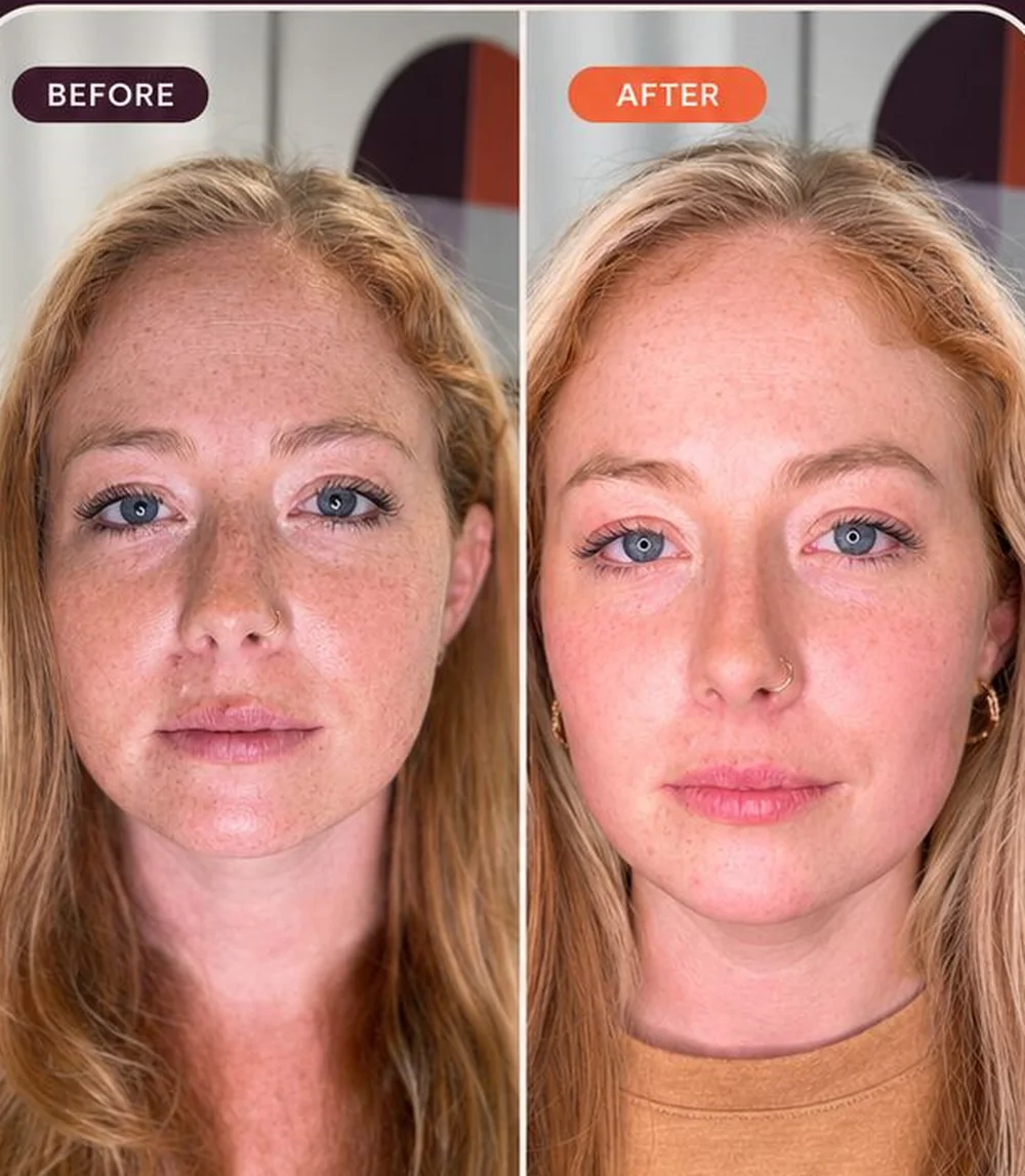 Real Rescu TriLift client, before and after