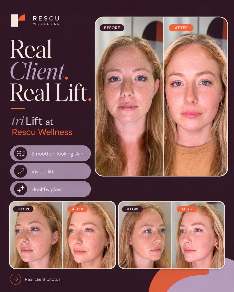 TRILIFT · REAL CLIENT