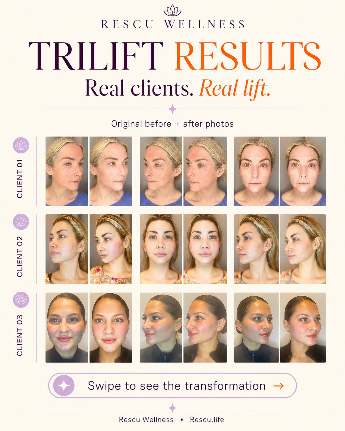 Real Rescu TriLift client results